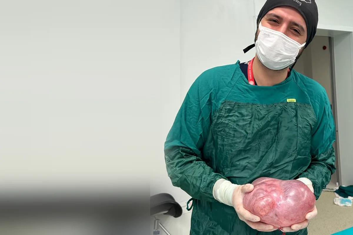 Op. Dr. Hüseyin Efe Akalın after surgery, holding the removed tissue